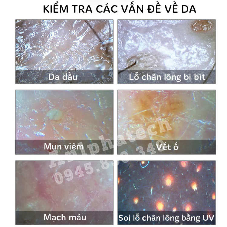 Hcm]Máy Soi Da Meiboyi Ipad-Màn Hình 11 Inch Thế Hệ Mới 2020-Nhiều Chế Độ  Soi | Lazada.Vn