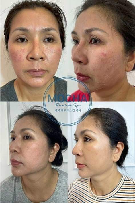 Peel da Mocha Retinol MUA 1 được 5 sản phẩm