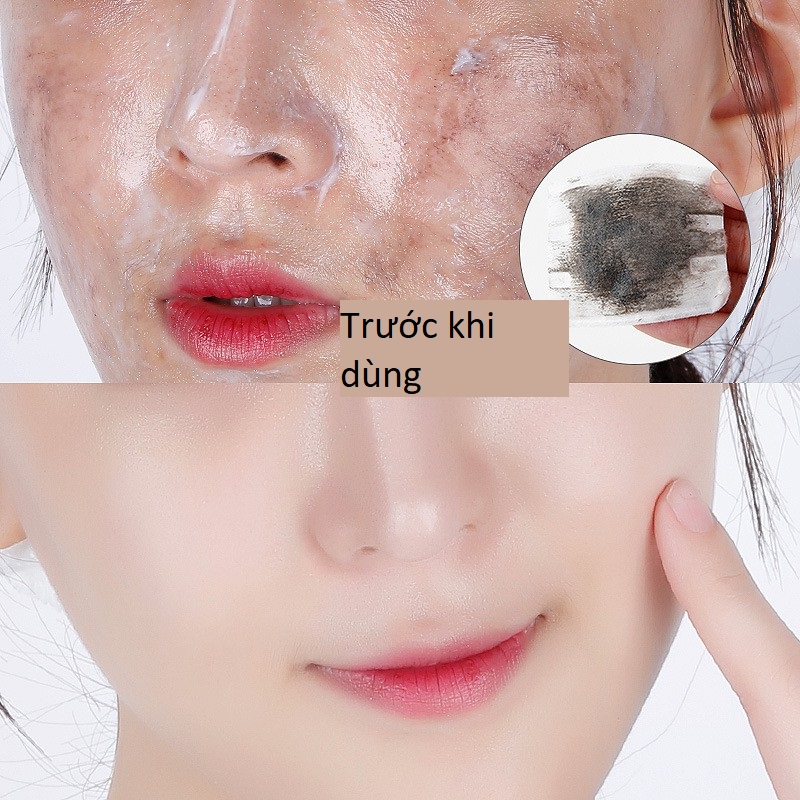 Hộp Kem Thải Độc Trị Thâm Da Mặt PIBAMY