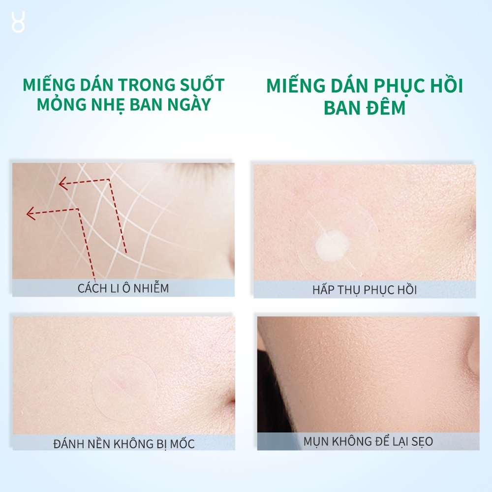 Miếng dán mụn Focalskin Acne Pimple Patch Day Night (60 miếng)