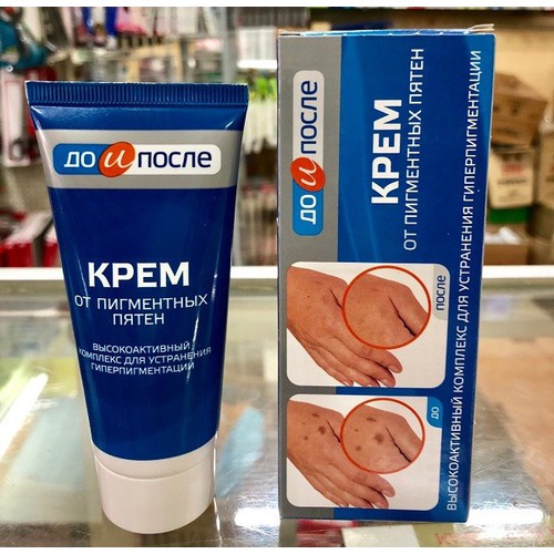 Kem đồi mồi Kpem Nga 50ml