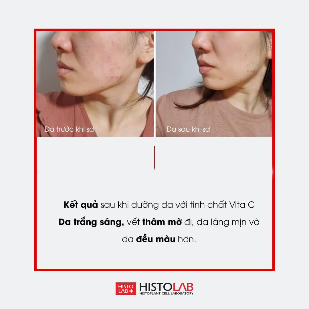 TINH CHẤT DƯỠNG TRẮNG DA - VITA C COMPLEX AMPOULE 47% HISTOLAB