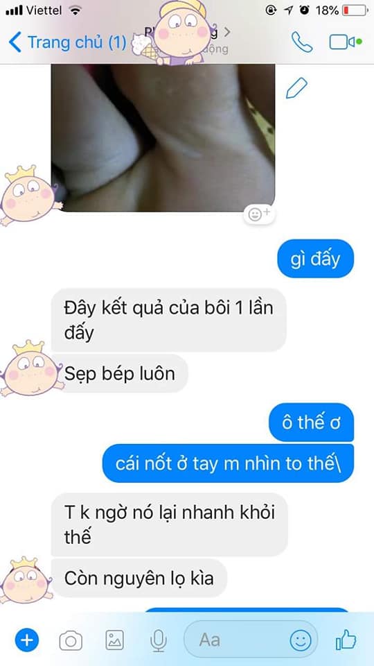 MIẾNG DÁN  MỤN CÓC  IBOKORORI 12 MIẾNG NHẬT BẢN