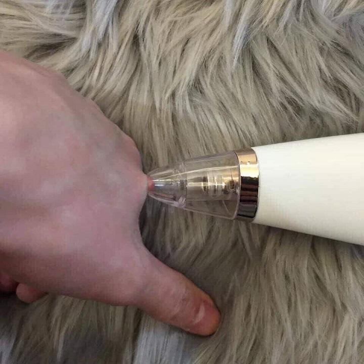 Máy hút mụn MINI CẦM TAY