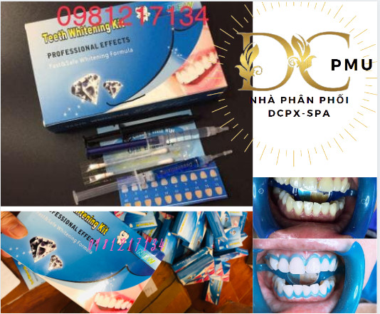 thuốc tẩy trắng răng pha sẵn (bật tông sau 30p)