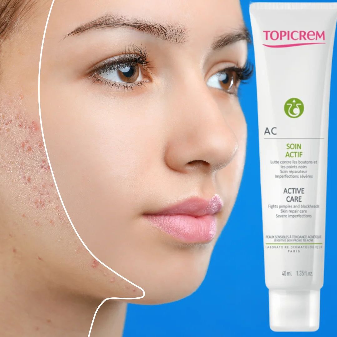 Kem dưỡng TOPICREM AC Active Care [40ml] giảm mụn cho da dầu mụn