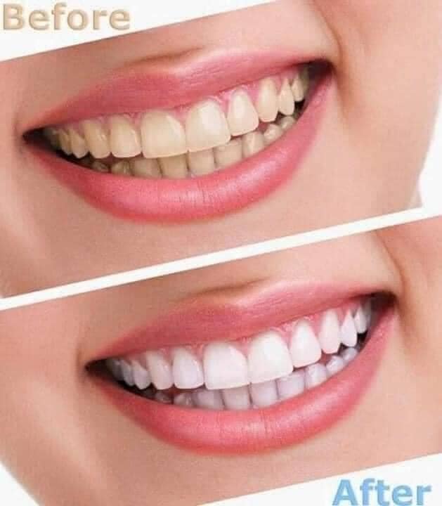 Kem đánh răng trắng răng Crest 3D White Brilliance 116g