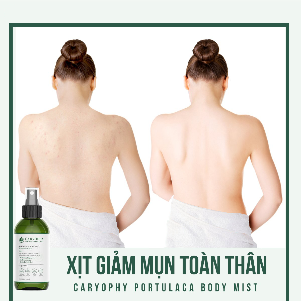 Xịt mụn lưng Caryophy Portulaca Body Mist 150ml