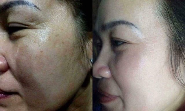 Kem Nám Tàn Nhang Hoa Đào