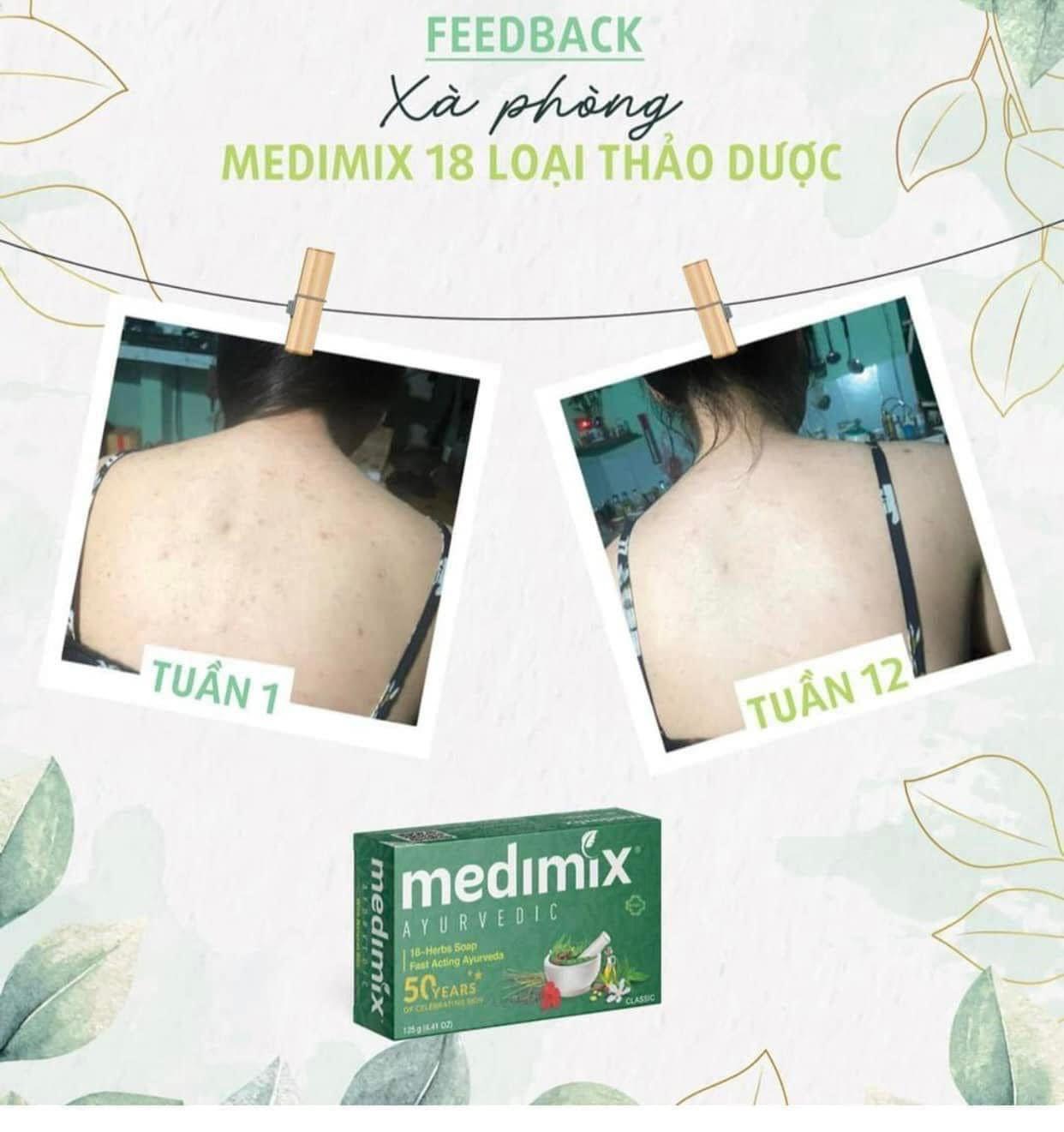 Xà Phòng Medimix 18 Loại Thảo dược dành cho da mụn lưng - nghệ giảm thâm - cỏ hương bài - nghệ tây dưỡng sáng da 125g