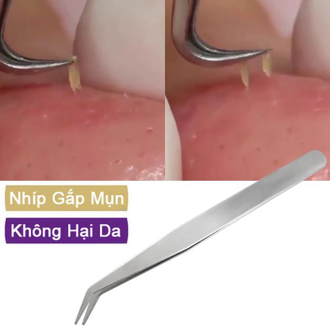 [HCM][Giá hủy diệt] Nhíp lấy mụn chiều dài 8.7 cm