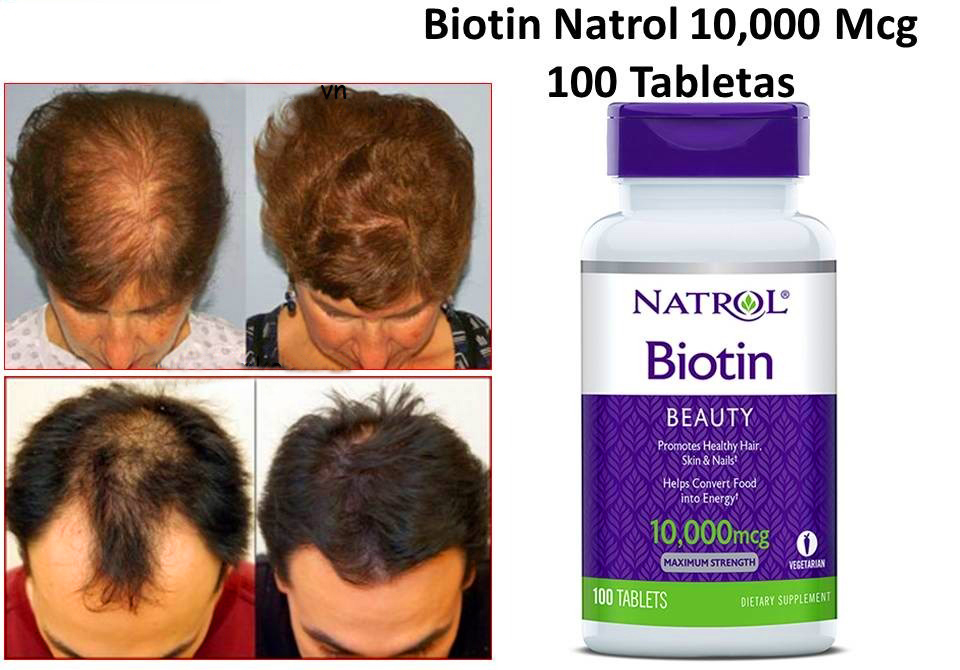 Viên uống mọc tóc Natrol Biotin 100 viên