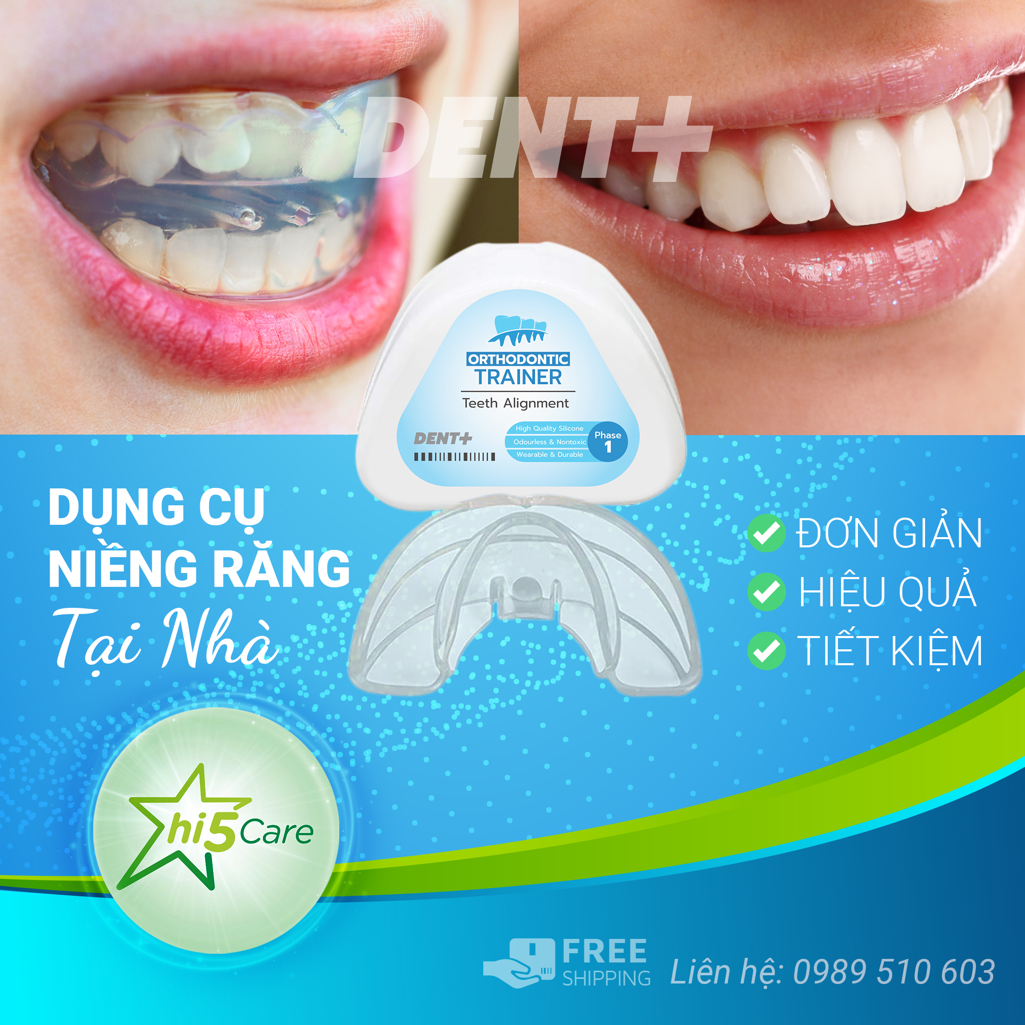 [HCM]Dụng Cụ Niềng Răng Tại Nhà ( 3 giai đoạn) | Đủ bộ 3 hàm A1+ A2 + A3