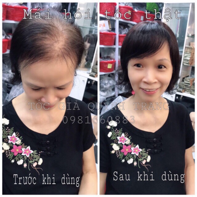 Tóc Che Hói Hàng Cao Cấp Có Da Đầu Đủ Màu Nhiều Độ Dài