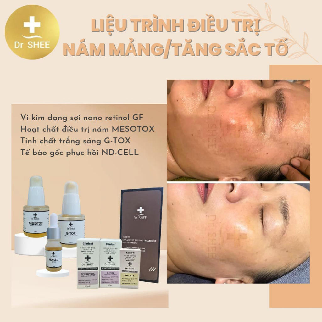 Tế bào gốc phục hồi NDCELL Dr.Shee