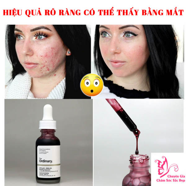 serum The Ordinary AHA 30% + BHA2 % Peeling Solution - 30ml