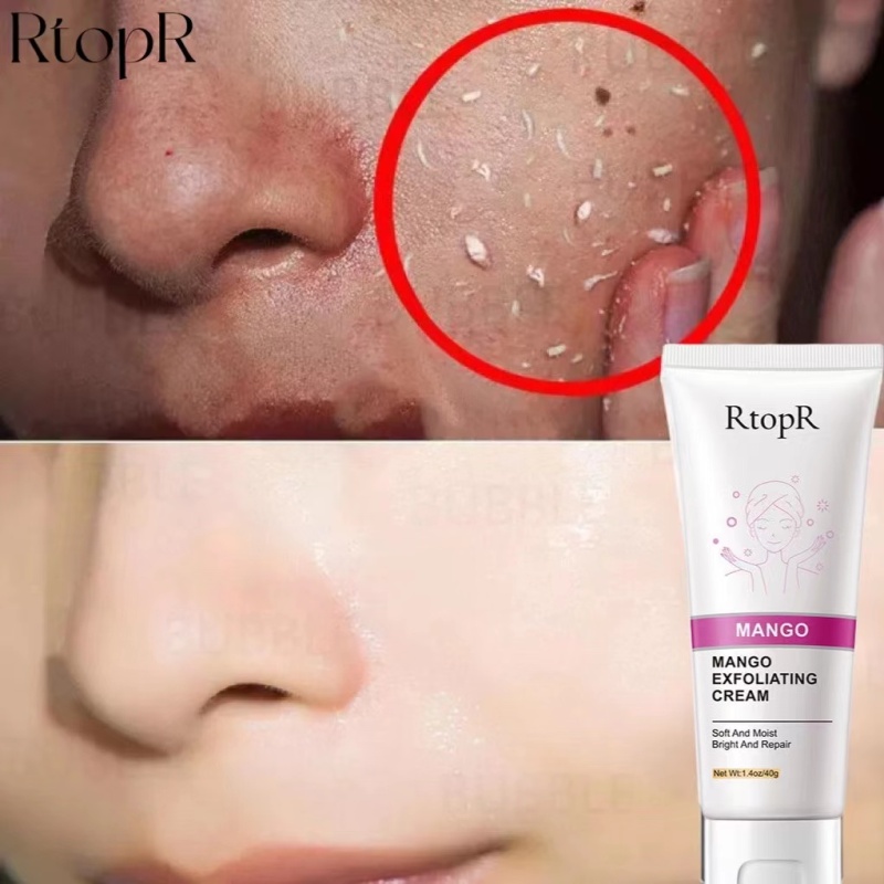 [HCM]RtopR Exfoliating Kem tẩy tế bào chết 40g làm sạch da mặt. loại bỏ mụn đầu đen dưỡng da mặt giá siêu tốt cao cấp