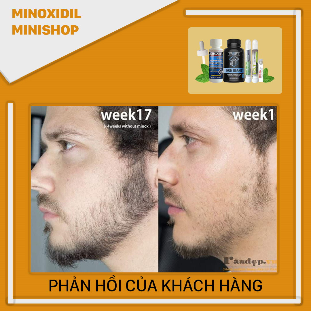 Combo Mọc Râu Tóc: Minoxidil 5% + Iron Beard + LCLT + Retinol + Peo mix