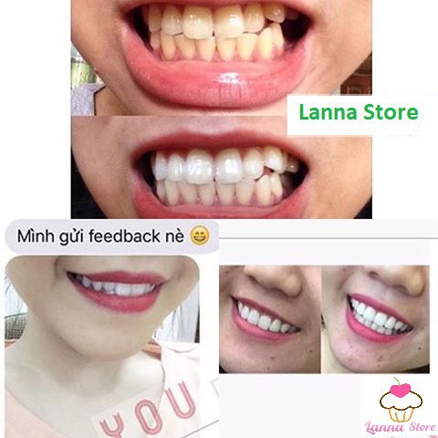[CHÍNH HÃNG ĐỦ LOẠI] 1 GÓI LẺ - Miếng dán trắng răng Crest 3D White - Mỹ (Professional Effects/ Supreme Flexfit/ Glamorous/ 1 hour)