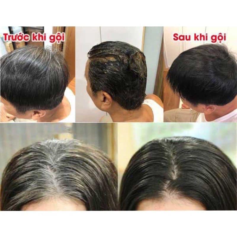 DẦU GỘI PHỦ BẠC NONI VISIAMI 200ML - GỘI LÀ ĐEN