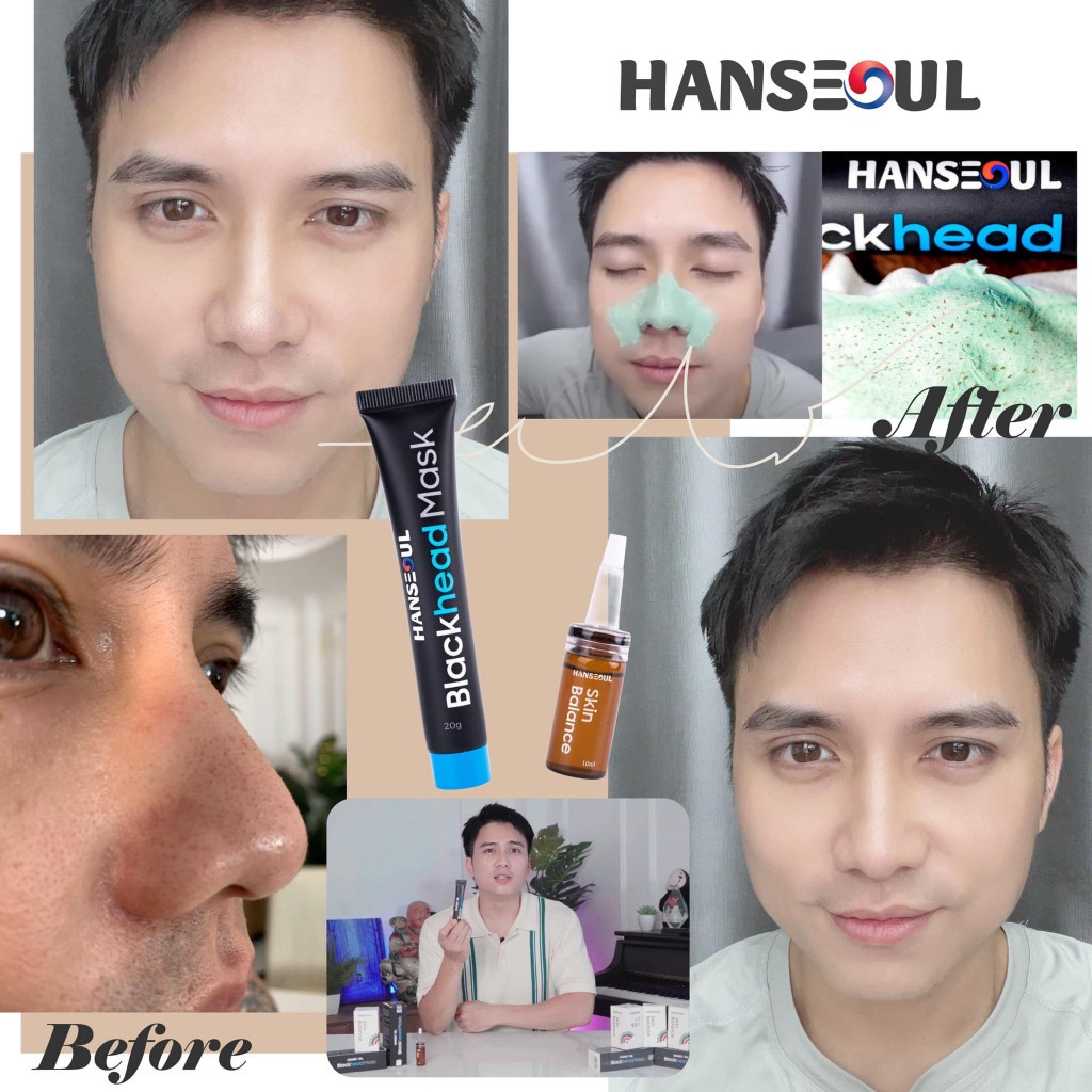Gel lột mụn cám,mụn đầu đen Blackhead Mask, mặt nạ lột mụn không gây đau rát, kháng khuẩn, se khít lỗ chân lông tuýp 20g chính hãng Hanseoul