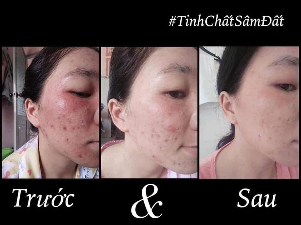Tinh Chất Sâm Đất