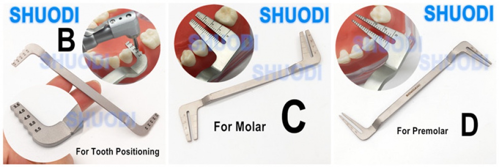 Nha khoa điện giả hướng dẫn bộ cấy ghép phẫu thuật định vị hướng dẫn định vị thiết bị định vị song song với độ sâu mở rộng bộ