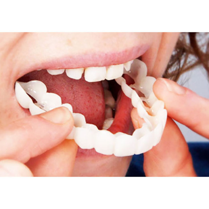 Răng giả snap on smile cải thiện đem lại nụ cười tự tin rạng ngời
