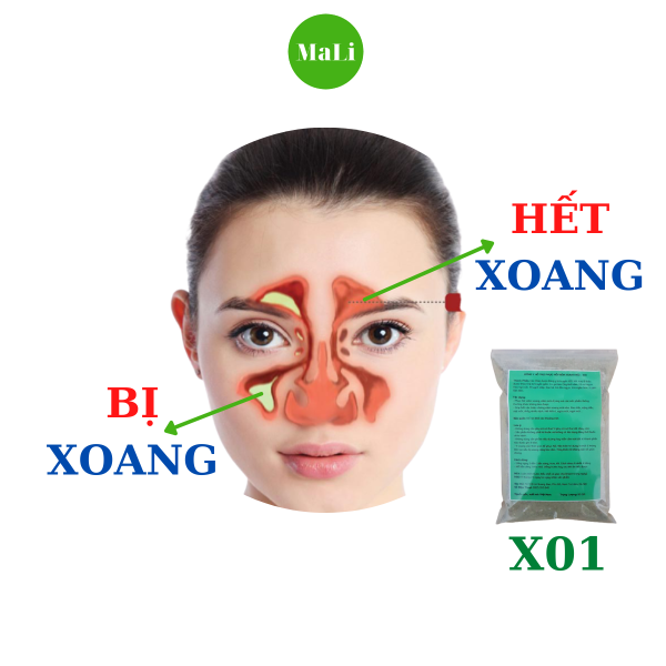 Bột uống Phục Hồi Xoang Mũi X01 giúp hết Ngứa đau Ngạt mũi, Hết dịch 90gr 1 gói, 100% tự nhiên