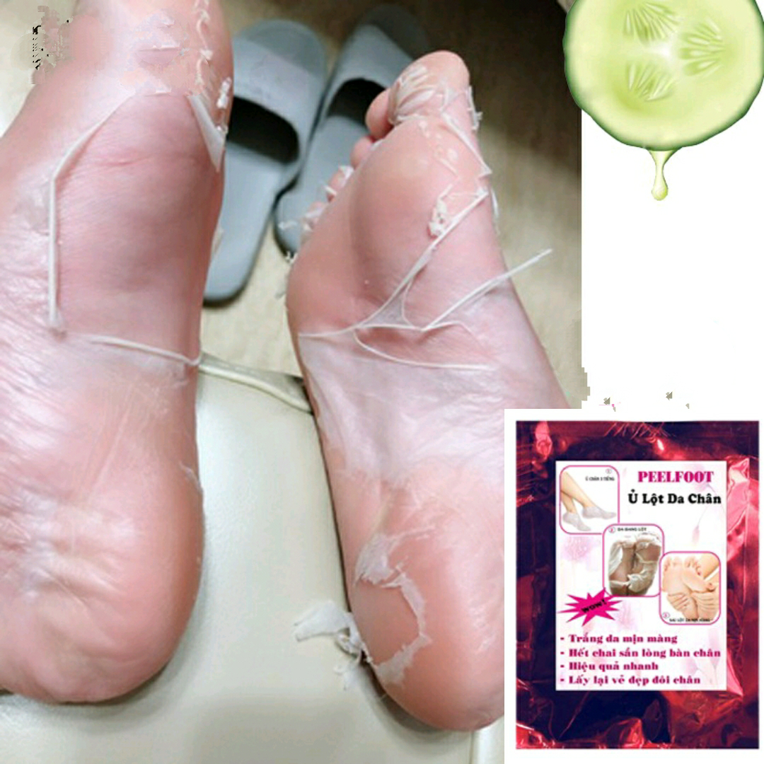 [HCM]Feelfoot Lột Trắng Da Chân Hết Chai Sần