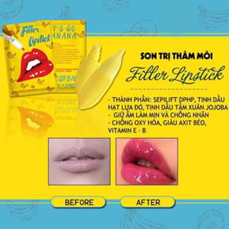 [MUA 1 TẶNG 1] Son Filler Khử Thâm Môi 🍌 Banana🍌