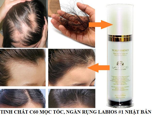 [CHÍNH HÃNG 100%] Tinh chất mọc tóc và ngăn rụng tóc Labios Scalp Essence 60ml
