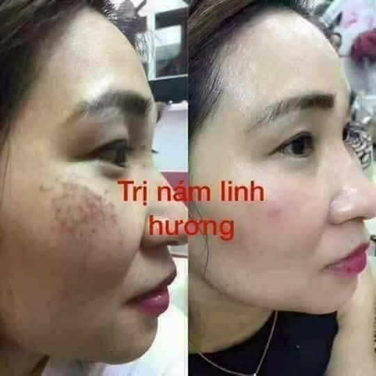 Tinh chất nám Linh Hương