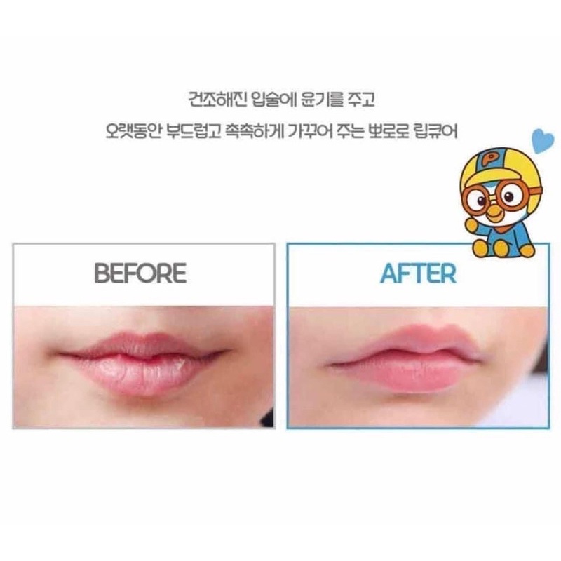 (Đủ Bill) Son Dưỡng Môi Cho Bé Pororo Hàn Quốc - Hee Authentic