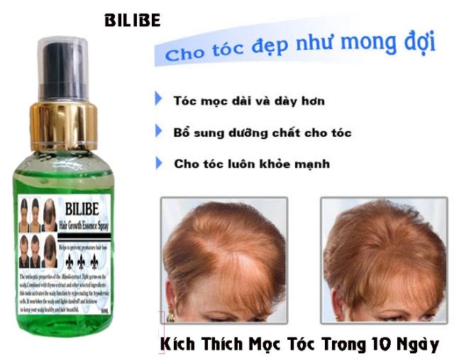 [HCM]Serum Mọc Tóc Dài Tóc Nam Nữ