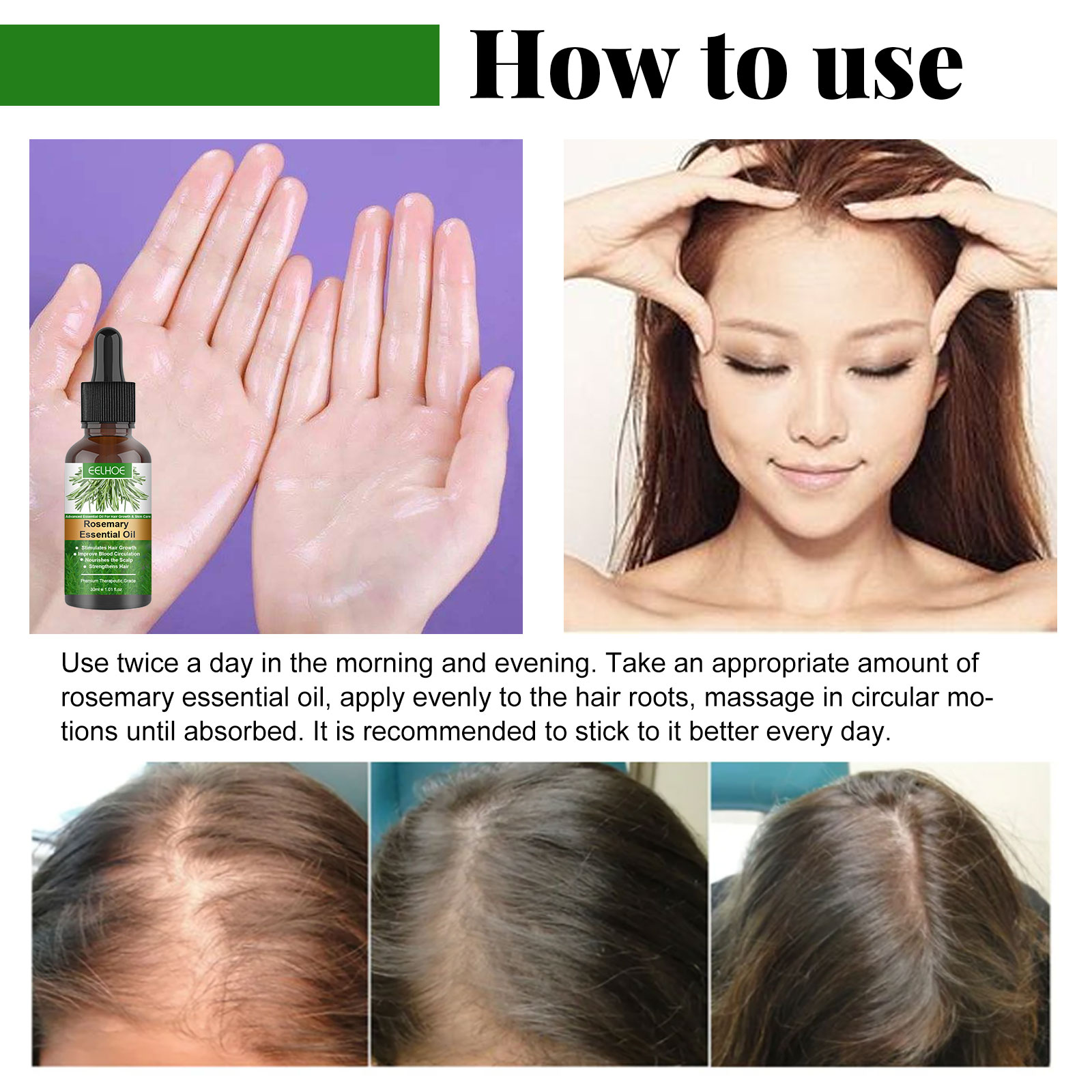 EELHOE Tinh Dầu Xịt Mọc Tóc 30ML Tinh Dầu Dưỡng Tóc Chống Rụng Mọc Tóc
