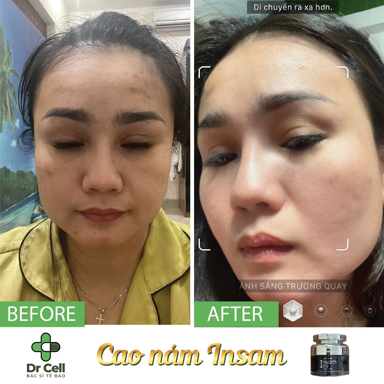 Cao Nám Insam Dr Cell 20g mờ thâm nám tàn nhang trắng da trẻ hoá da