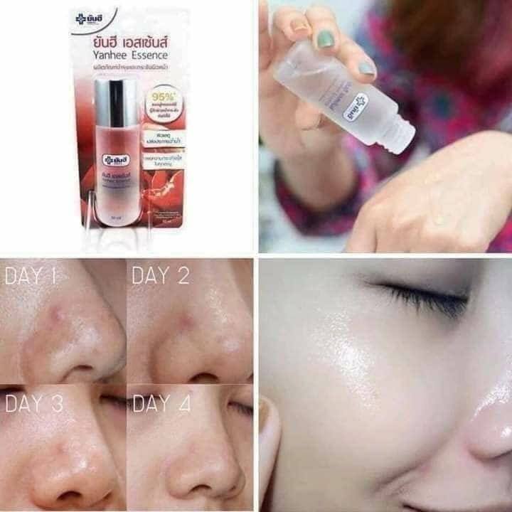 Nước Hoa Hồng YANHEE ESSENCE Thái Lan