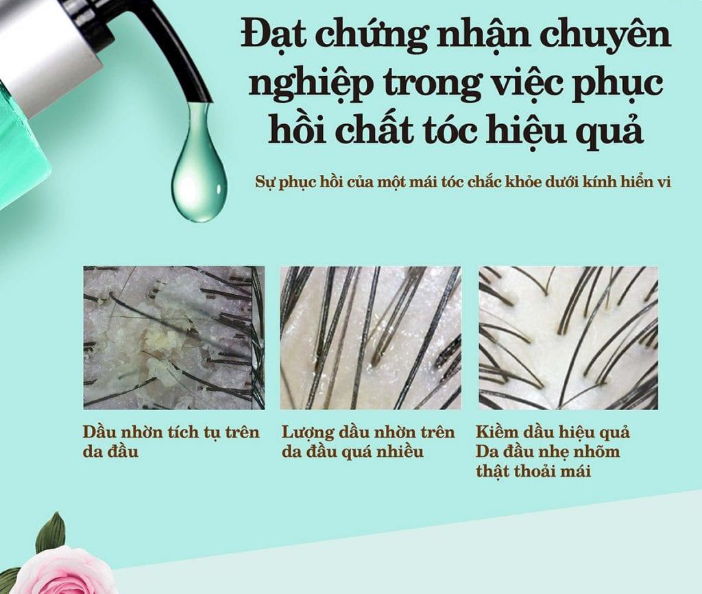 Dầu Gội Dành Cho Tóc Dầu Parco Oil Control 400ml