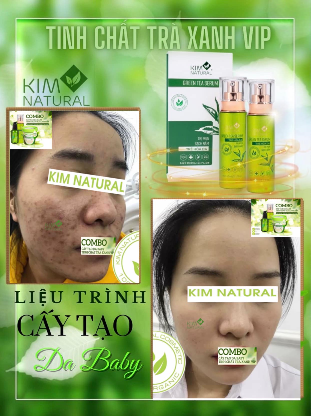 Tinh Chất Trà Xanh VIP Kim Natural
