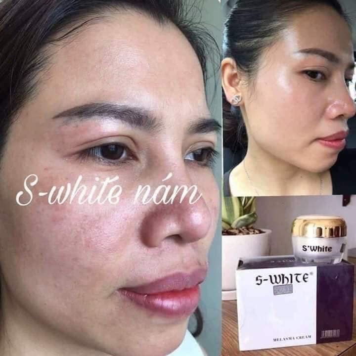 [HCM]KEM FACE NÁM CAO CẤP SWHITE