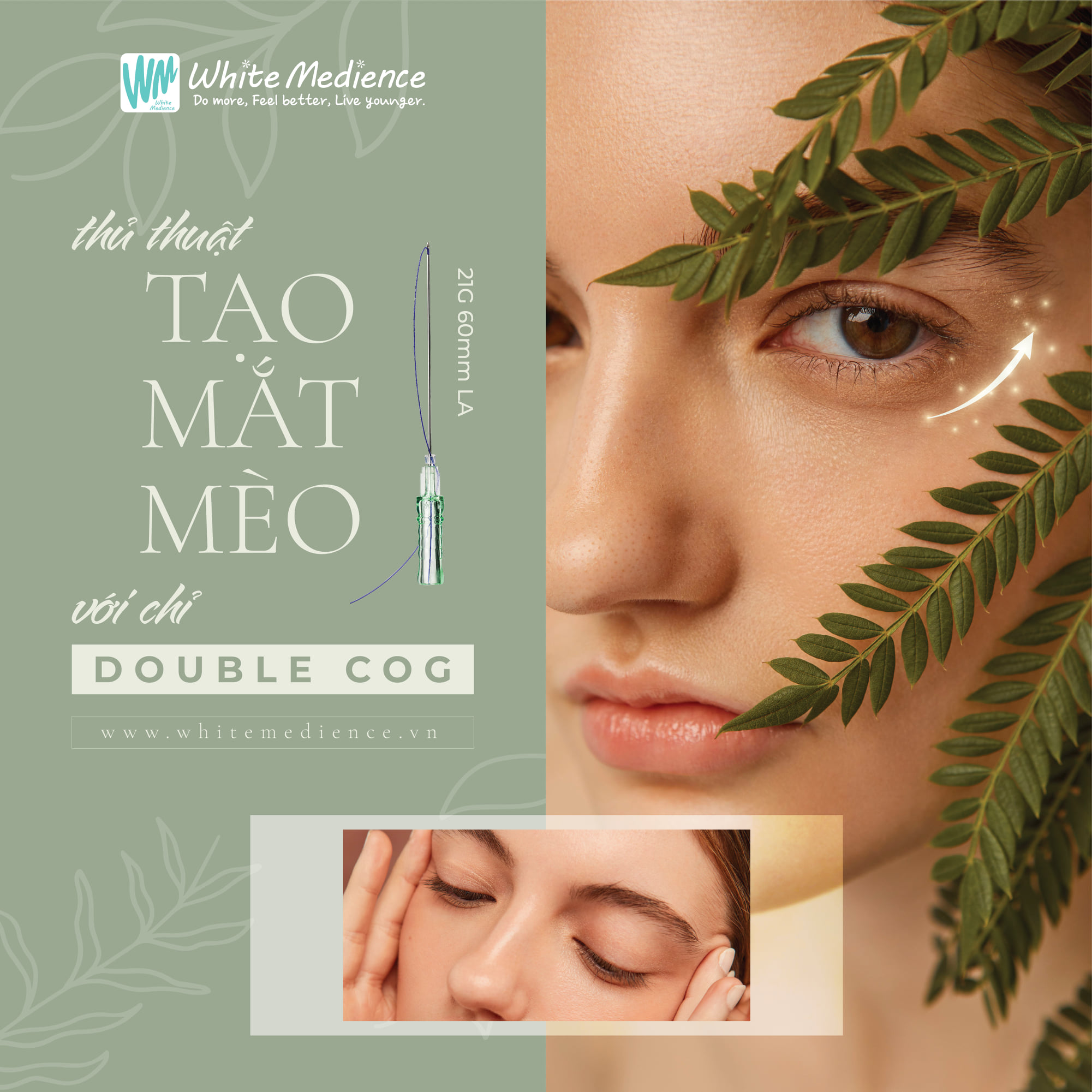 Chỉ nâng cơ mặt Double Cog White Medience gói 12 sợi