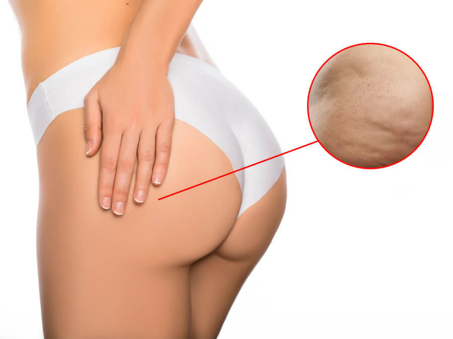 Xà Phòng Giảm Thâm Mông Pelican Nhật Bản