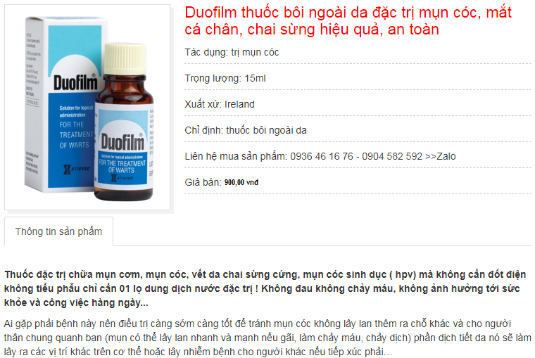 chai chân, mụn cóc, chai sừng, mụn cơm, virut hpv, smg