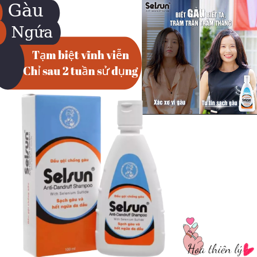 Dầu gội chống gàu Selsun 50ml/100ml