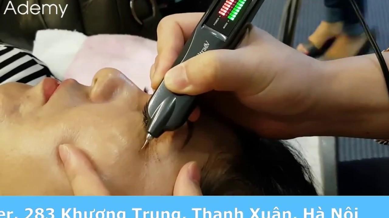 Máy Nhấn Mí Plasma Hàn Quốc