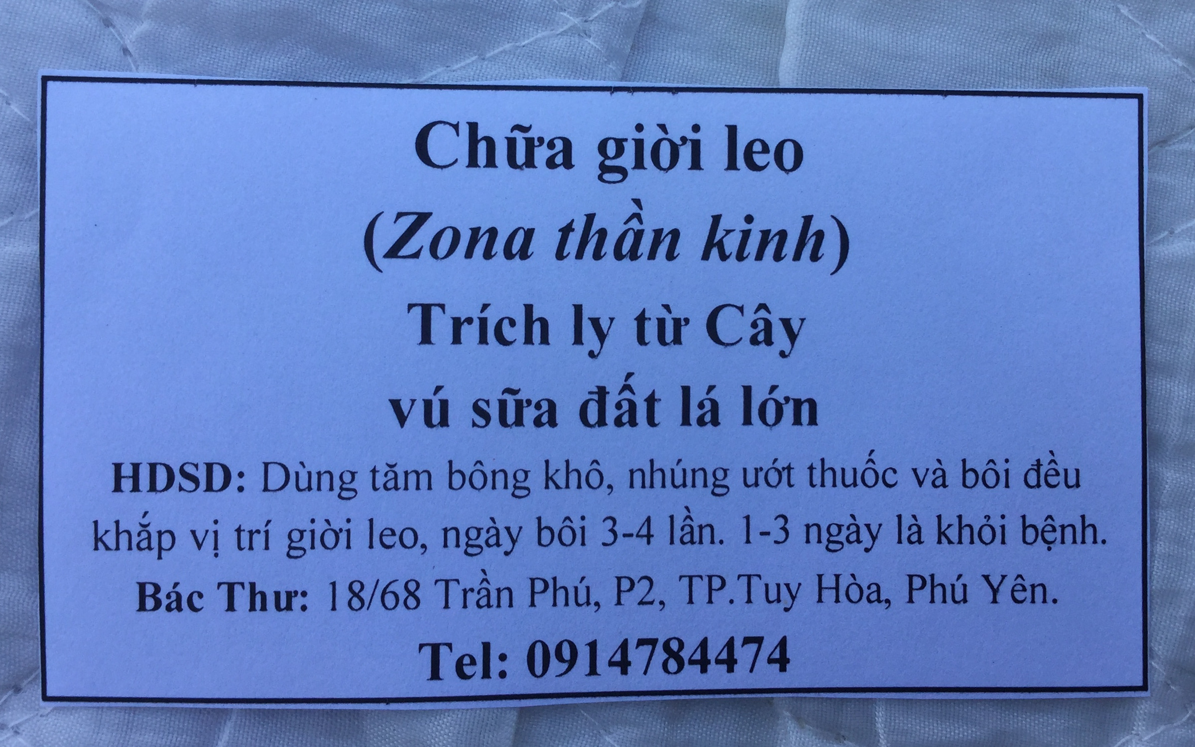 Giời leo, zona thần kinh