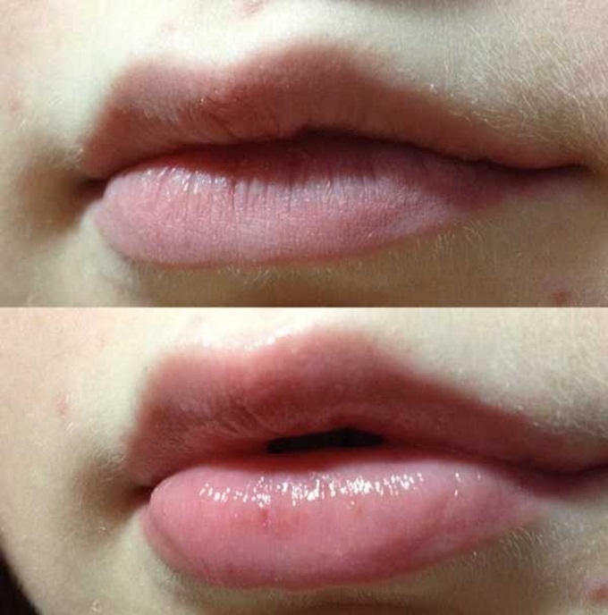 Sáp Vaseline 100% Pure Petroleum - Có Lựa Chọn