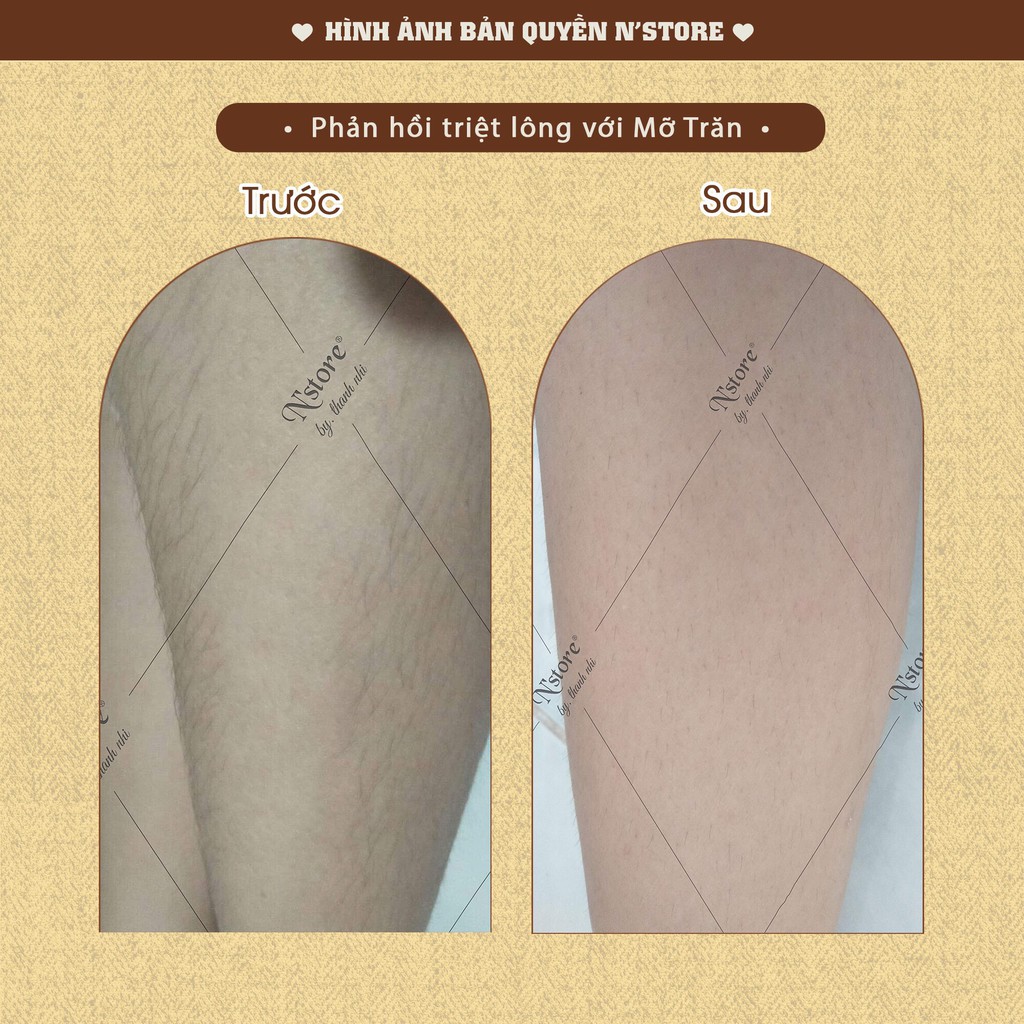 Tinh Chất Mỡ Trăn Nguyên Chất triệt lông, mờ rạn da N'Store 75gr