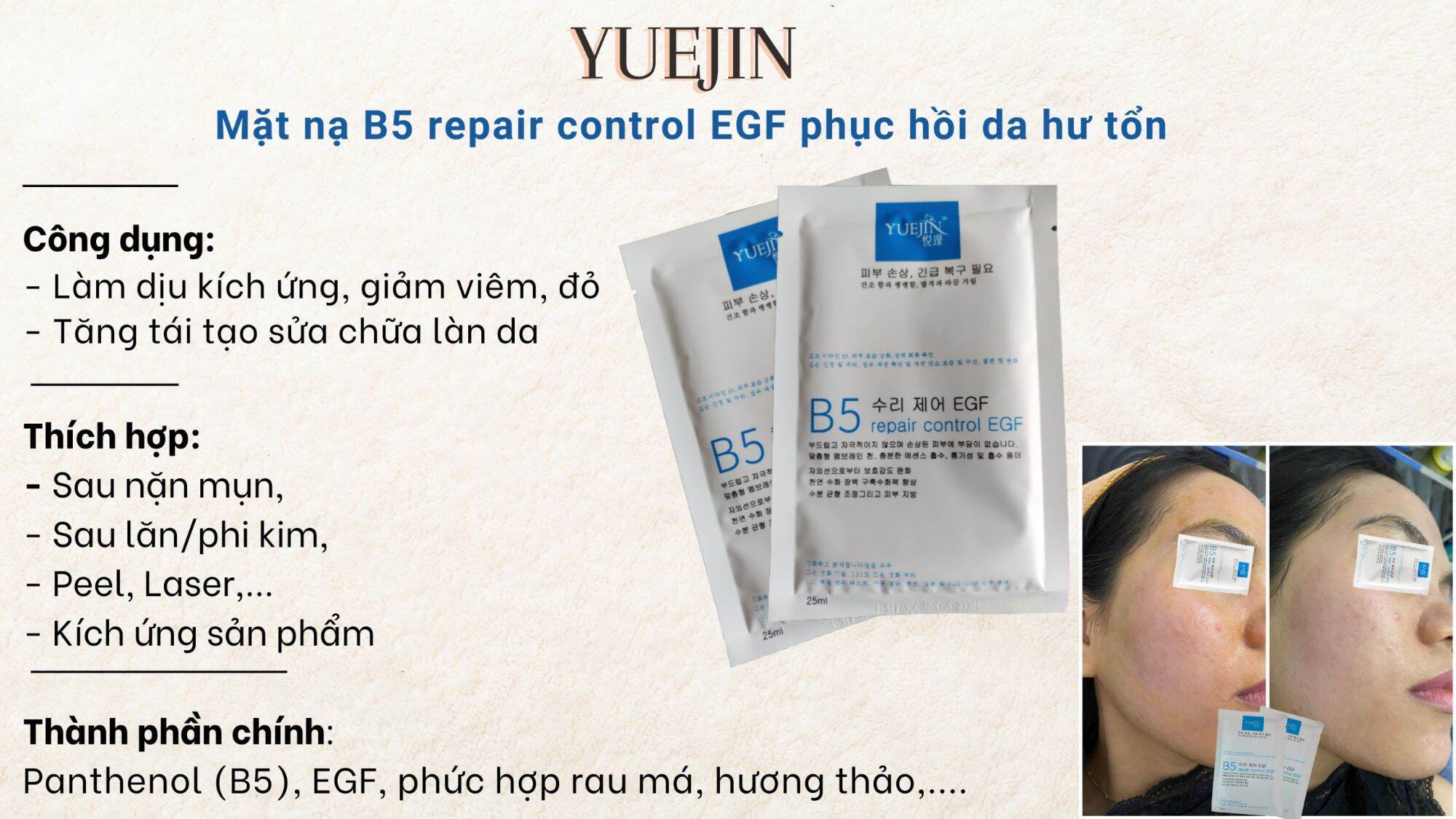 [Free Ship] [Hot] Mặt nạ Yuejin B5 cấp ẩm, phục hồi da